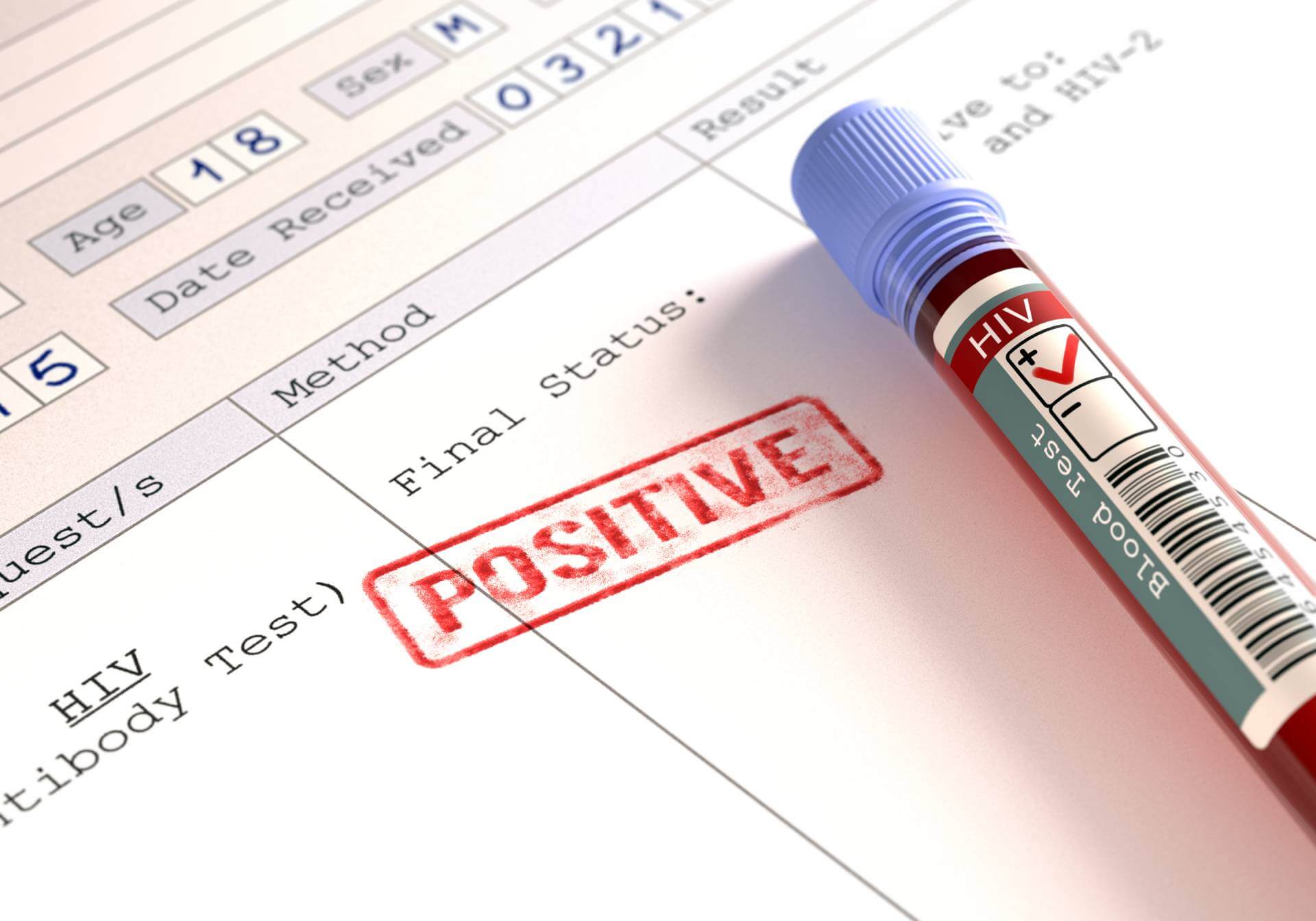 Blood test positive for HIV
